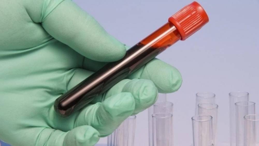 imunoglobulina-1512576060