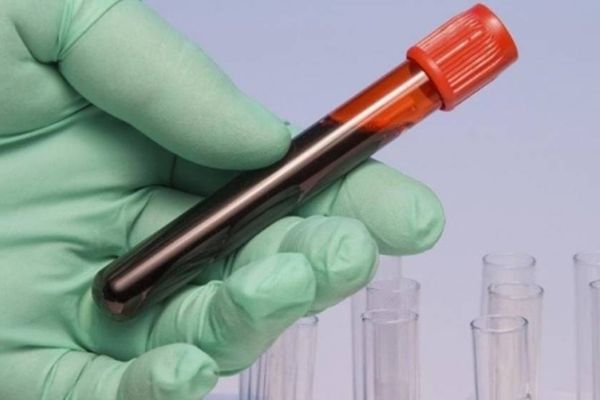 Consiliul Concurenței a intrat pe fir în cazul ”Imunoglobina”